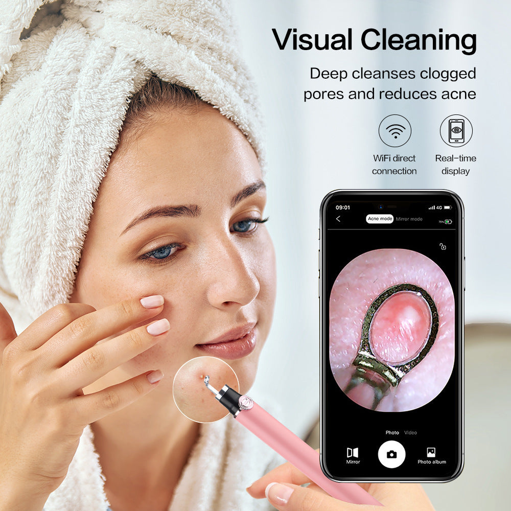 Advanced Wireless Pore Cleaning Tool-0